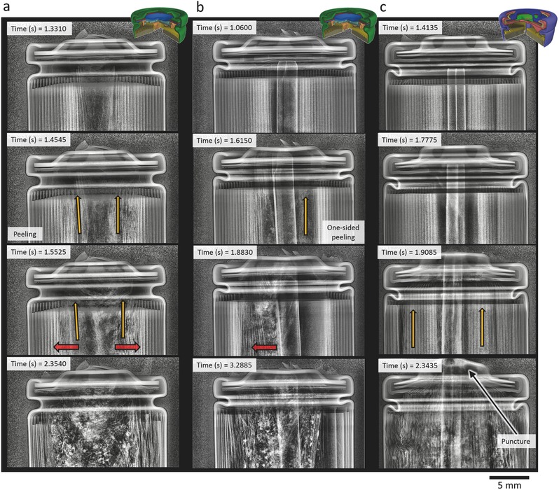 X-ray thermal runaway